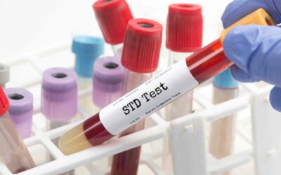 Confidential and Affordable STD Testing