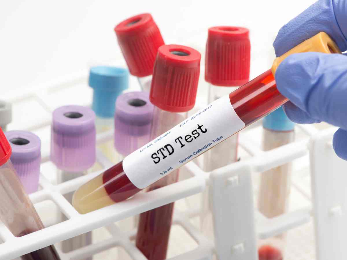 STD testing Get reliable, confidential STD testing in Duluth at ARCpoint Labs. Choose from basic panels, full screenings, or individual tests—no insurance needed.