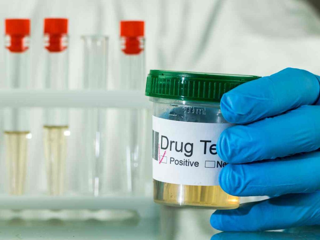 5 Common Drug Tests Employers in Duluth Use—And What to Expect