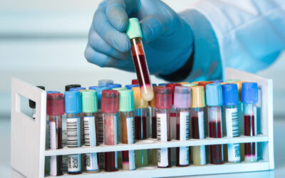 PEth Alcohol Test in Duluth, GA