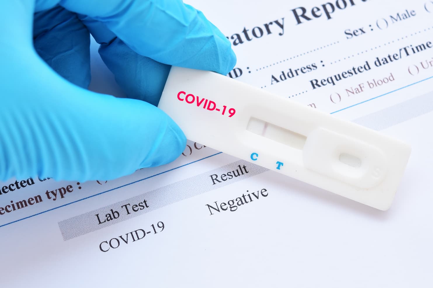 Jarun Ontakrai (1) Are Covid Tests Reliable in 2024?