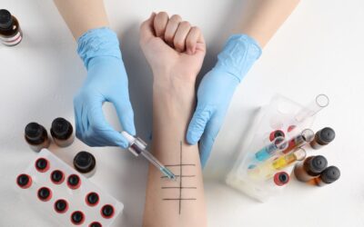What are Food & Allergy Sensitivity Panels?