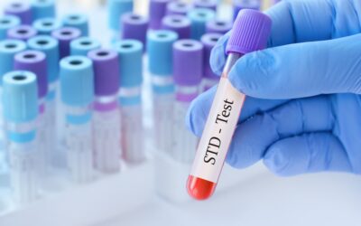 How Long Does It Take to Get STD Test Results?