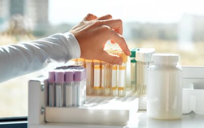 How Often Should You Get Routine Blood Work?