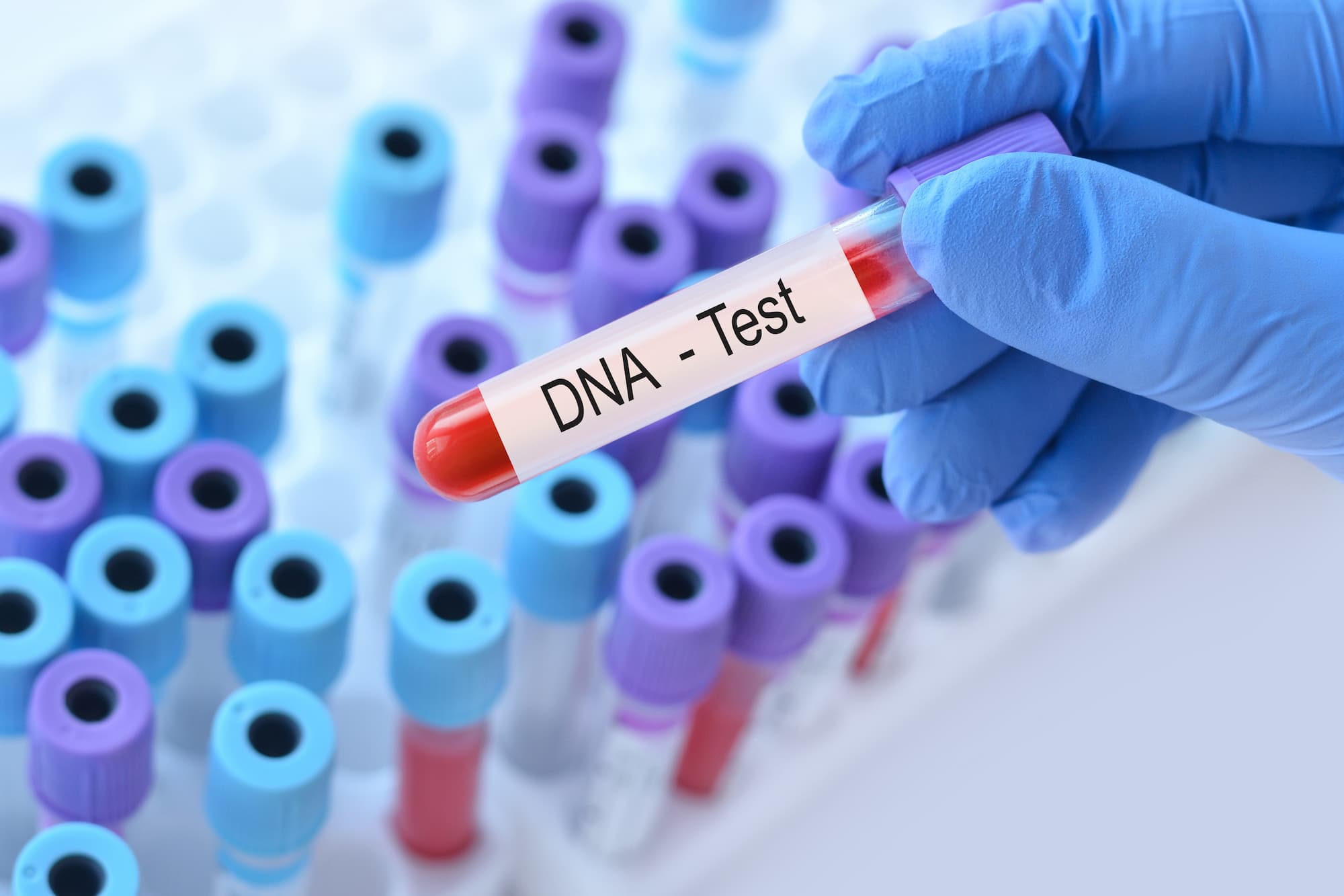 an image of a test tube reading DNA test an image of a test tube reading DNA test