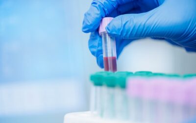What Is a PEth Test? Alcohol Detection, Results & When It’s Used