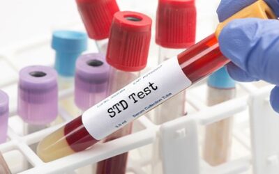 STD Testing Without Insurance: Everything You Should Know