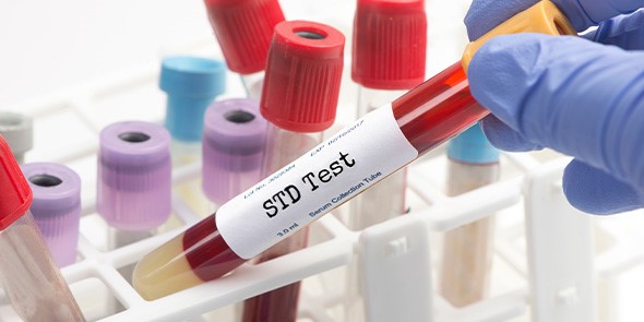 std-test