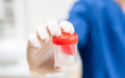 What is an ETG Drug Test?