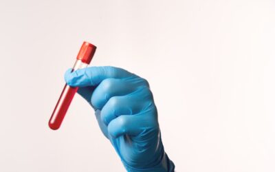 Where in San Rafael to Get an Unknown Substance Tested
