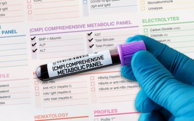 What is a Normal Comprehensive Metabolic Panel (CMP) Result?