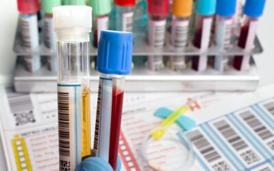 Annual Blood Work Checklist: What Tests Should You Get Every Year?