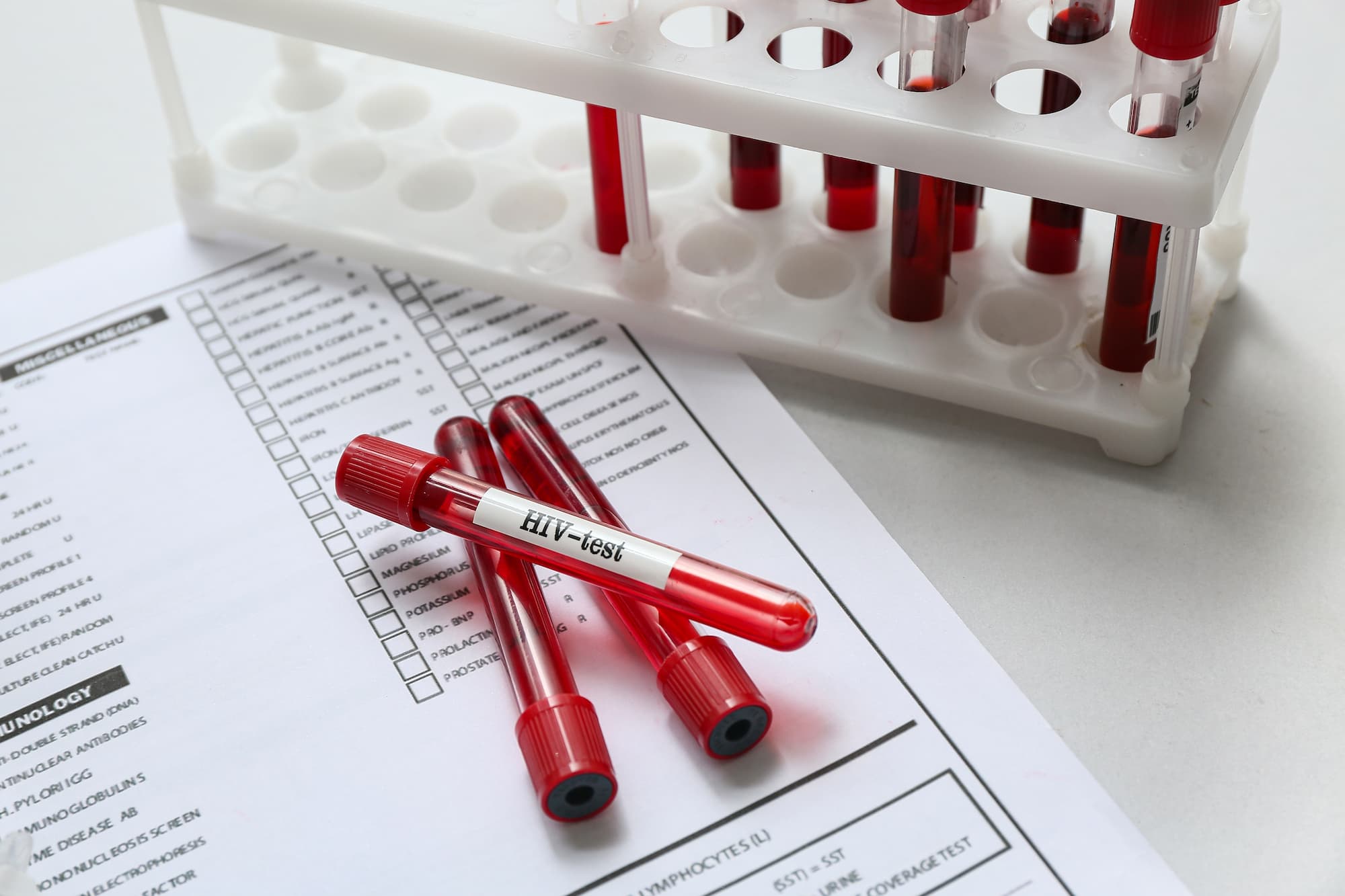 Laboratory blood test tubes and medical forms used to determine biological age and track longevity biomarkers. Laboratory blood test tubes and medical forms used to determine biological age and track longevity biomarkers.