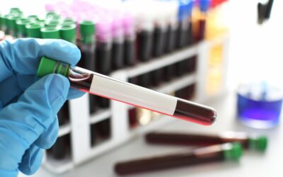 Understanding Testosterone: The Essential Blood Panels Before Starting TRT