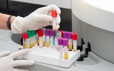 How Often Should You Get Tested for STDs?
