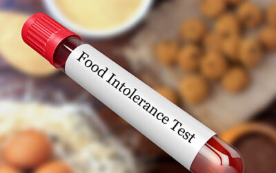 3 Reasons Why You Should Get an ALCAT Food Sensitivity Test