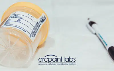 Which Drug Test Does Probation or Parole Use?