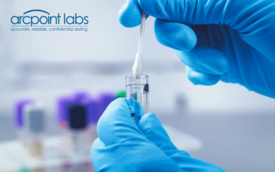 One Simple Way to Understand the Chlamydia Testing Procedure