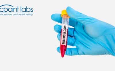 Everything You Need to Know About Tuberculosis Testing for School Requirements