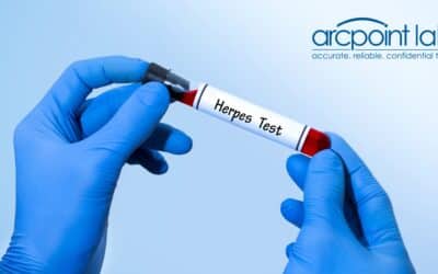 Herpes Testing Procedures: What You Need to Know