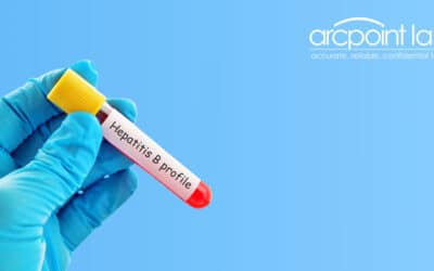 Understanding How Hepatitis Testing Works