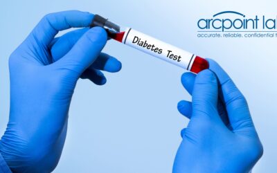 Comprehensive Diabetes Testing Services at ARCpoint Labs