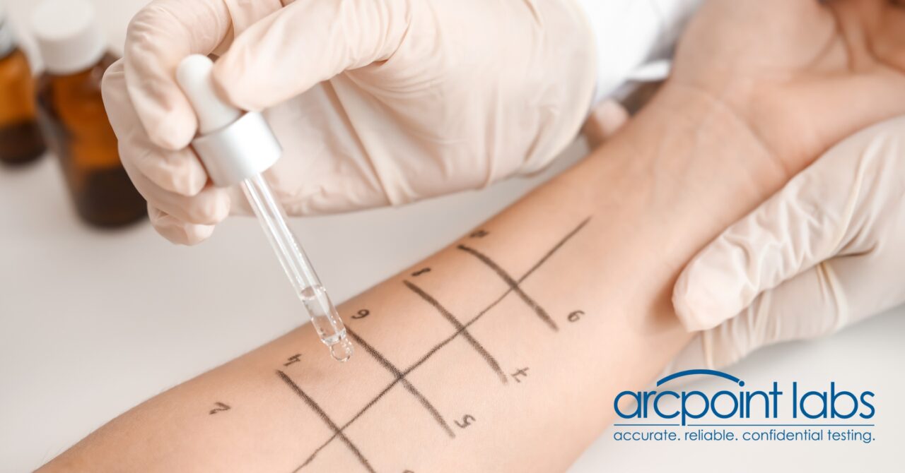Transform Your Health with Precision Food Allergy Testing - ARCpoint Labs