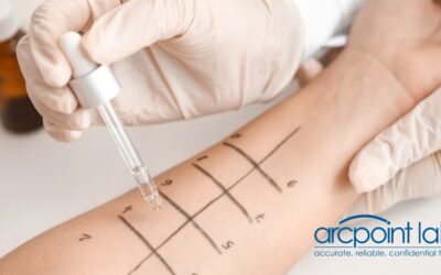 Transform Your Health with Precision Food Allergy Testing