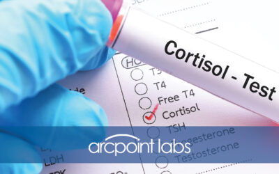 Cortisol Testing and What It Reveals About Stress